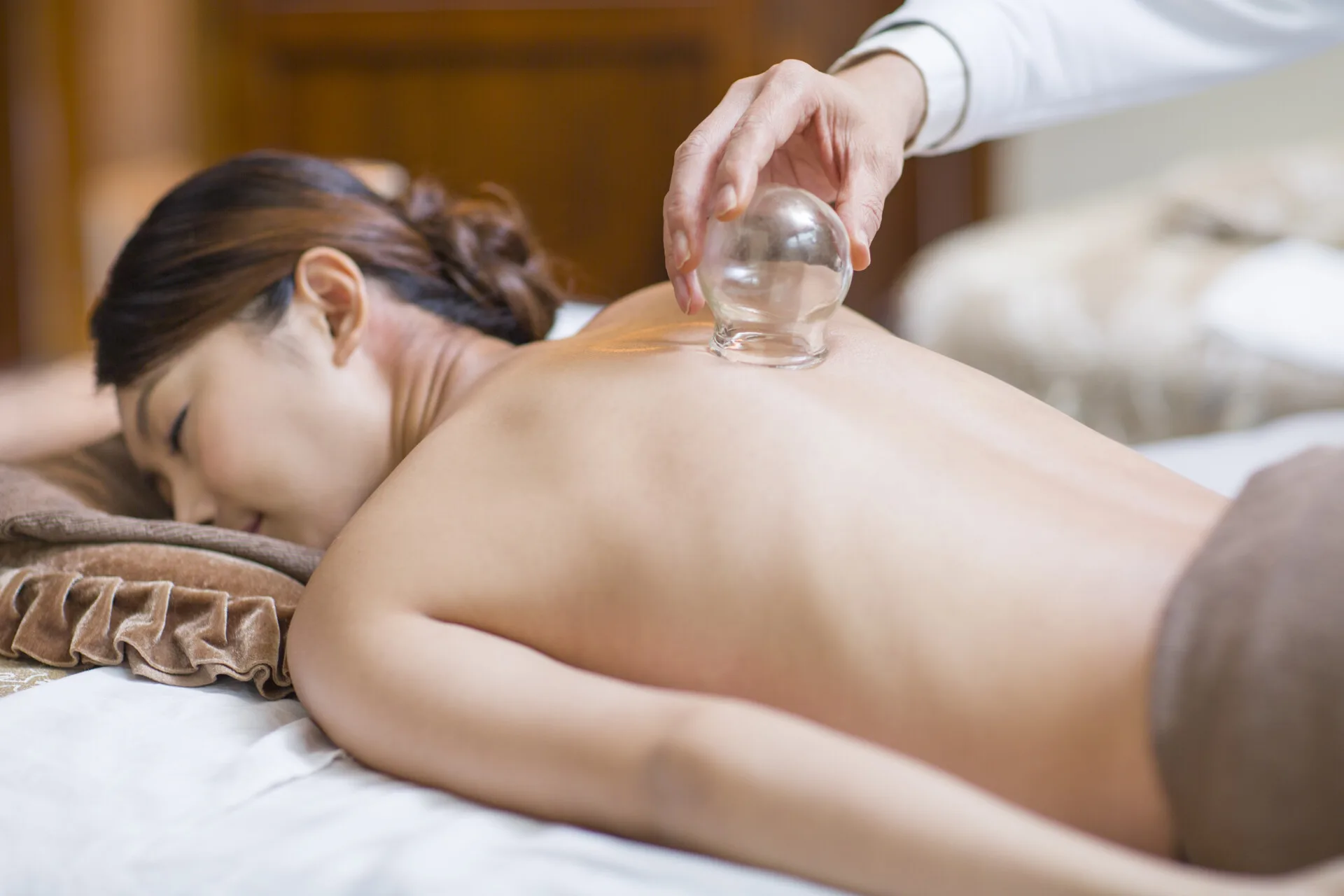 Cupping therapy treatment on a person's back. Glass cups are suctioned to the skin.